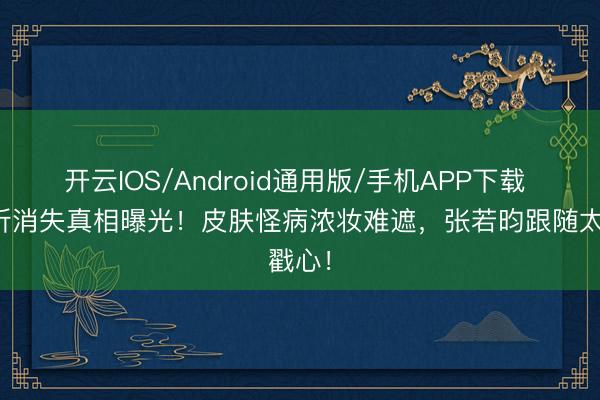 开云IOS/Android通用版/手机APP下载 唐艺昕消失真相曝光！皮肤怪病浓妆难遮，张若昀跟随太戳心！